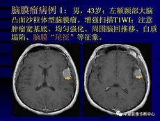 男性功能内裤趋势观察|男士内裤一个潜力巨大的增量市场