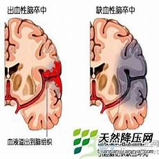哪里隆胸好隆胸手术一般亦不会影响哺乳的能力